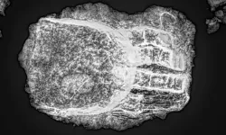 Orta Çağ'da gömülü iskeletin üzerinde gizemli protez el bulundu