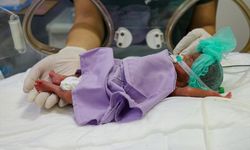 Van YYÜ Dursun Odabaşı Tıp Merkezinde tedavi edilen parmak bebek yaşama tutundu