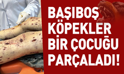 Başıboş köpekler bir çocuğu parçaladı!