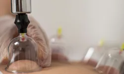 Hacamat için en uygun günler hangileri? İşte Hacamat Takvimi
