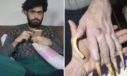 Türkiye'nin konuştuğu Barış'ın yeni işini ve son halini görenler şaşıp kalıyor