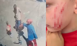 Van’da bir kadının 4 yaşındaki çocuğa saldırdığı anların görüntüsü ortaya çıktı!