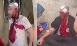Van’da komşular arasında taşlı, sopalı kavga: Çok sayıda kişi yaralandı!