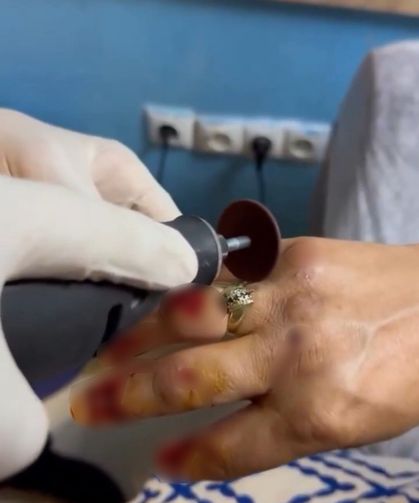 Van’da nefes kesen kurtarma operasyonu: Önce kaza sonra yüzük kabusu oldu!