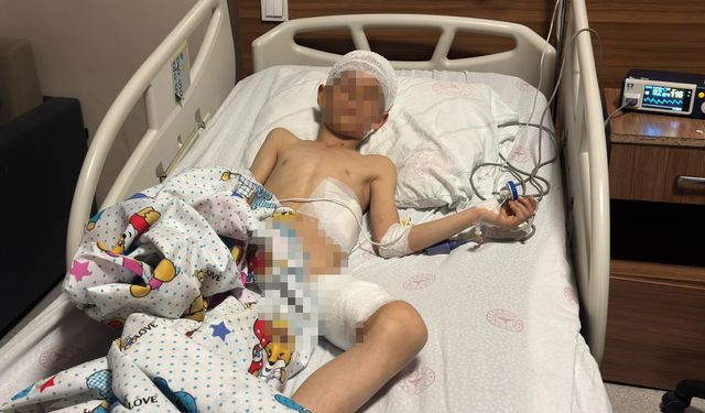 Van’da 5 yaşındaki çocuğun hayatını kaybettiği köpek saldırısında kan donduran detaylar!