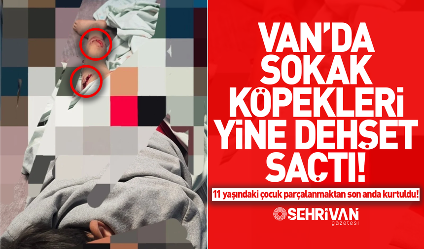 Van’da sokak köpekleri yine dehşet saçtı: 11 yaşındaki çocuk parçalanmaktan son anda kurtuldu!