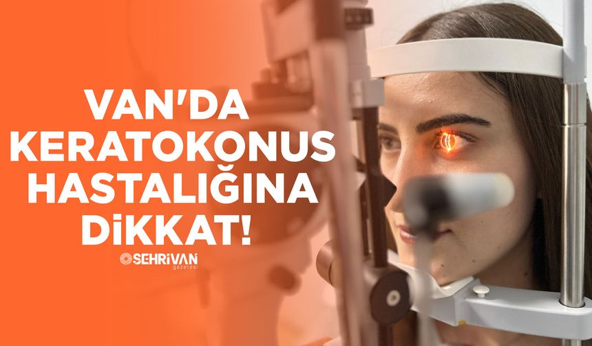 Van'da keratokonus hastalığına dikkat!