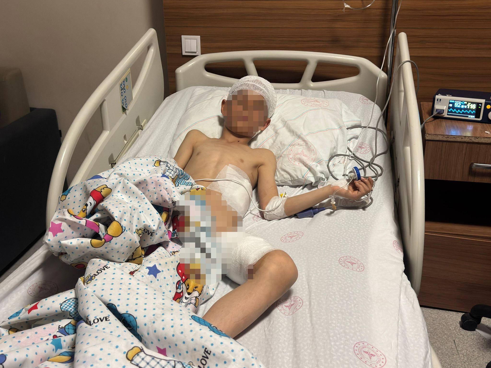 Van’da 5 yaşındaki çocuğun hayatını kaybettiği köpek saldırısında kan donduran detaylar!