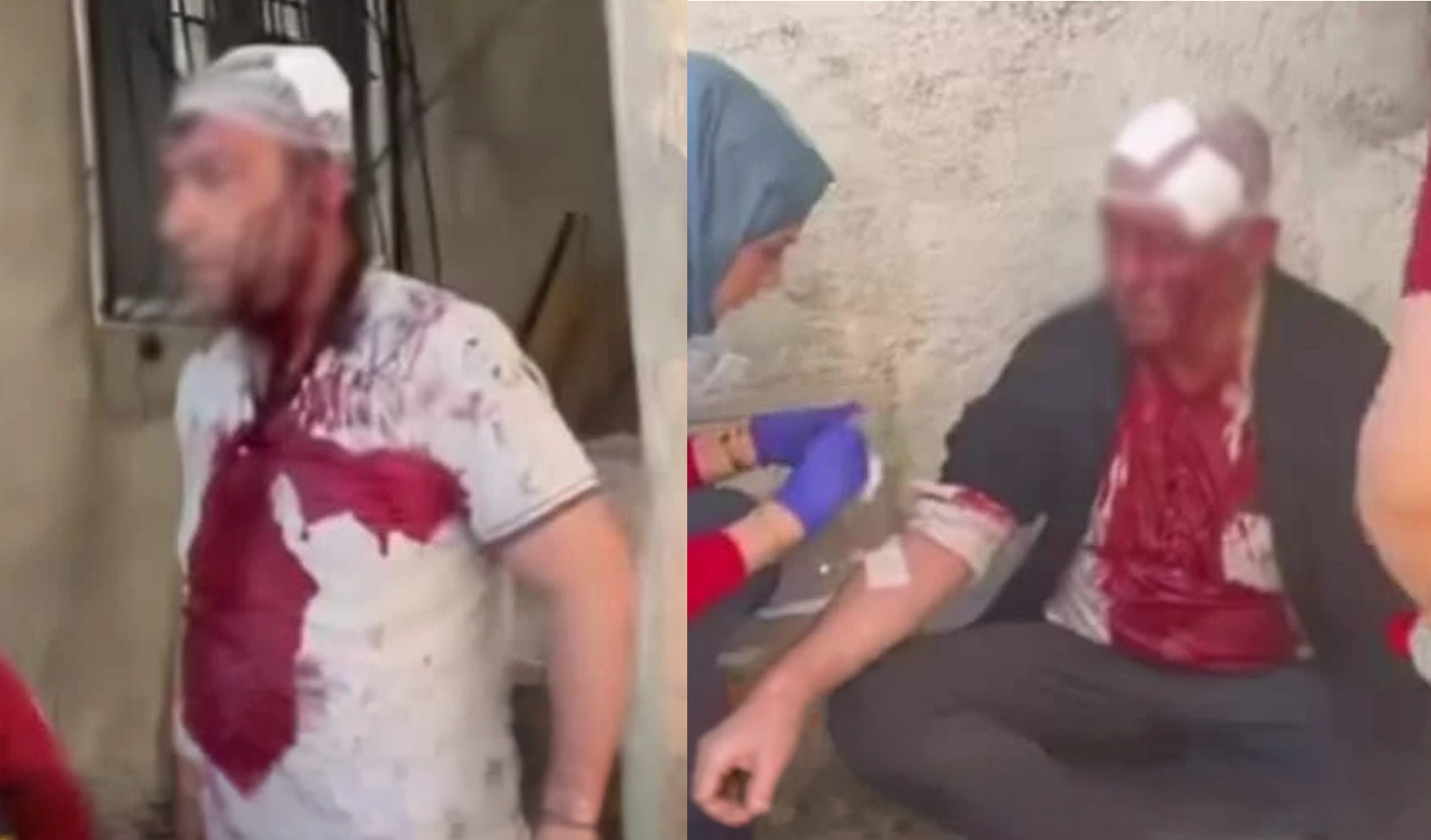 Van’da komşular arasında taşlı, sopalı kavga: Çok sayıda kişi yaralandı!